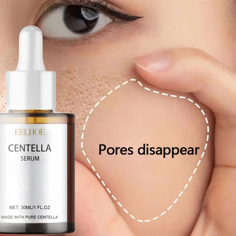Centella Asiatica Toner - ツボクサ顔血清栄養乾燥肌スムージング若返り肌美白美白クリーム顔の保湿剤韓国