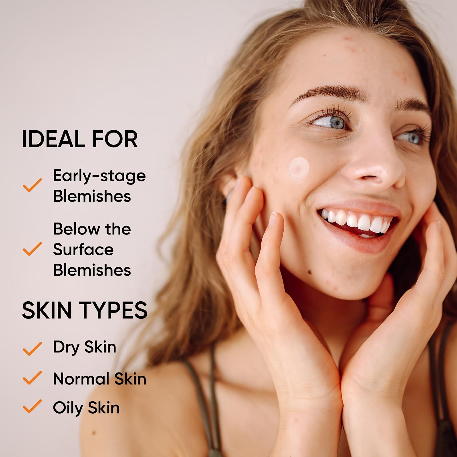 大型ハイドロゲルニキビパッチXLサイズ（顔と体用）、8サイズ - Xl Skincare のレビューと価格