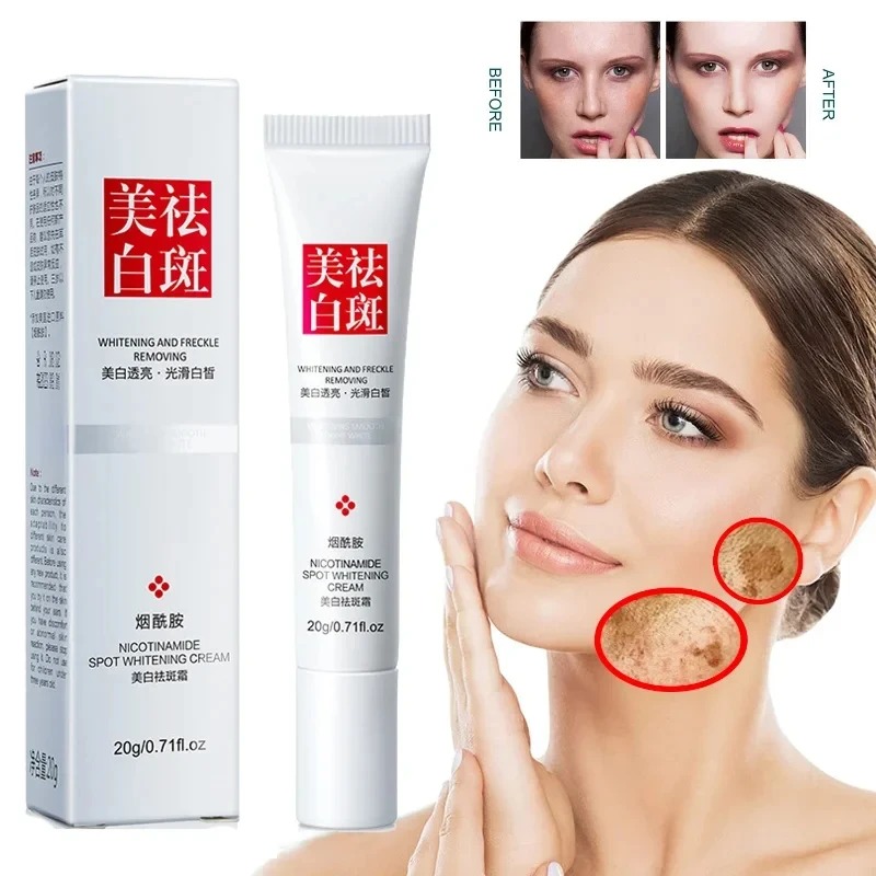 そばかすの色褪せと改善 ブラックスポット フェイスクリーム  - Skincare Glow のレビューと価格