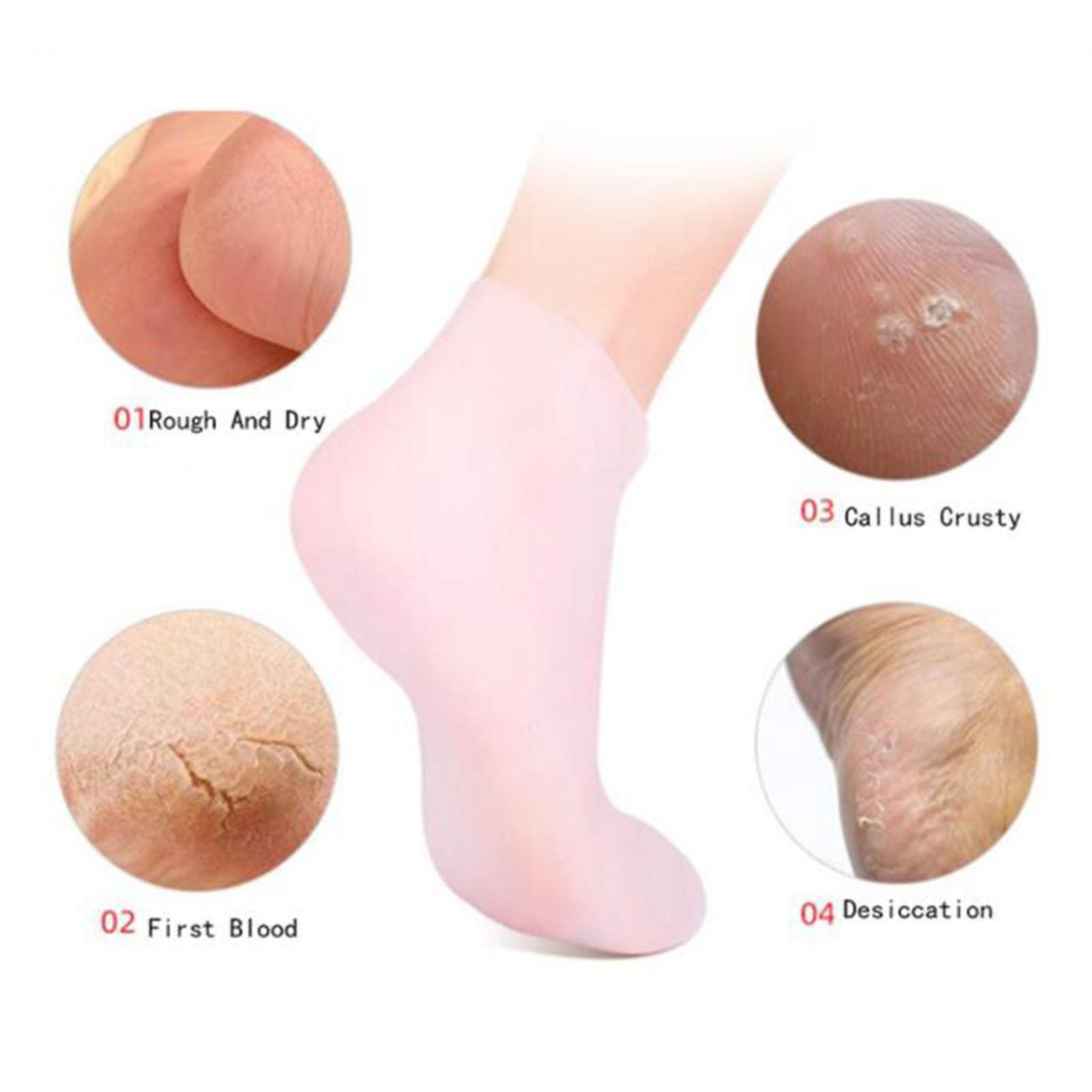 ソフトシリコンジェルソックス つま先ソックス 保護フットケア - Xl Skincare のレビューと価格