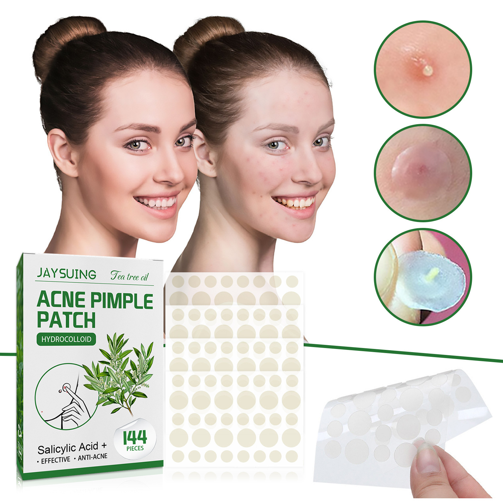 ハイドロコロイドニキビパッチ - 膿や油を吸収し、赤みを軽減 - Hydrocolloid Acne Patch のレビューと価格